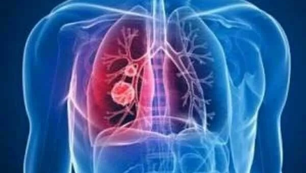 PNEUMONIE